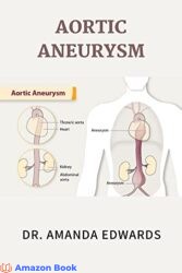 AORTIC ANEURYSM Signs, Symptoms, Prevention and Secrets to Maintaining a Healthy Lifestyle For Persons Living with Aortic Aneurysm